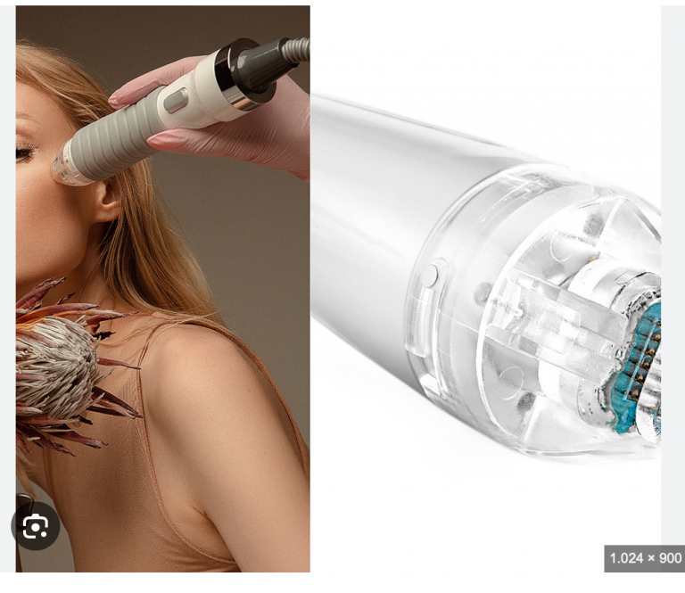 Alles, was Sie über Radiofrequenz-Microneedling in Frankfurt wissen müssen Einleitung